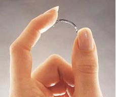 essure birth control